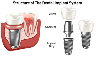 The Dental Square Guwahati
