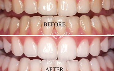 The Dental Square Guwahati